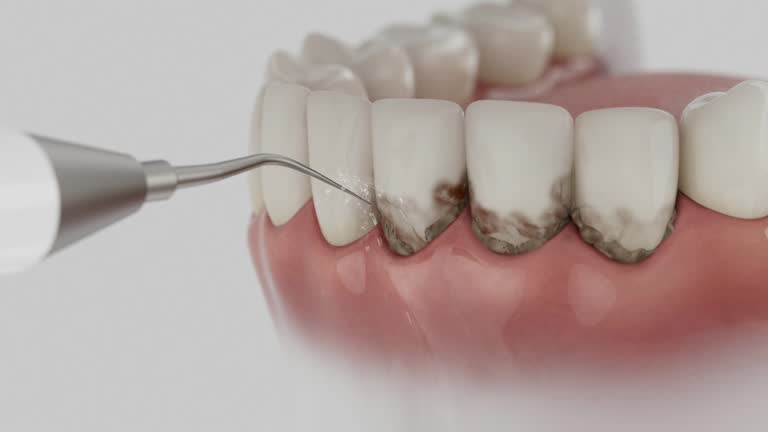 Reliable Dental Implants contractor in Avilla, AR by Smile Center Dentistry